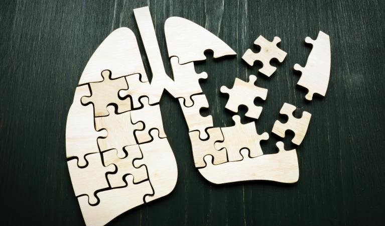 Lungs made of puzzle pieces, with some pieces missing.