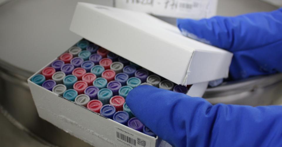 Biopankkinäytteitä